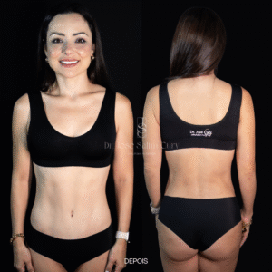 Mommy Makeover - autoestima da mulher