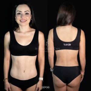 la maternidad - mommy makeover