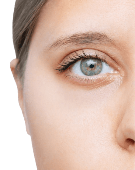 Blefaroplastia