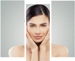 Facelift ou preenchimento facial? - mini lifting