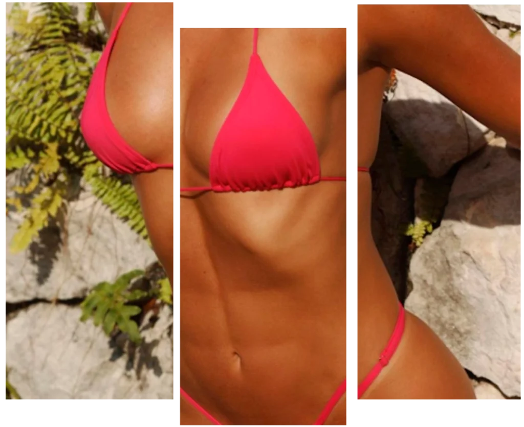 Lipoaspiração ou Lipoescultura em São Paulo