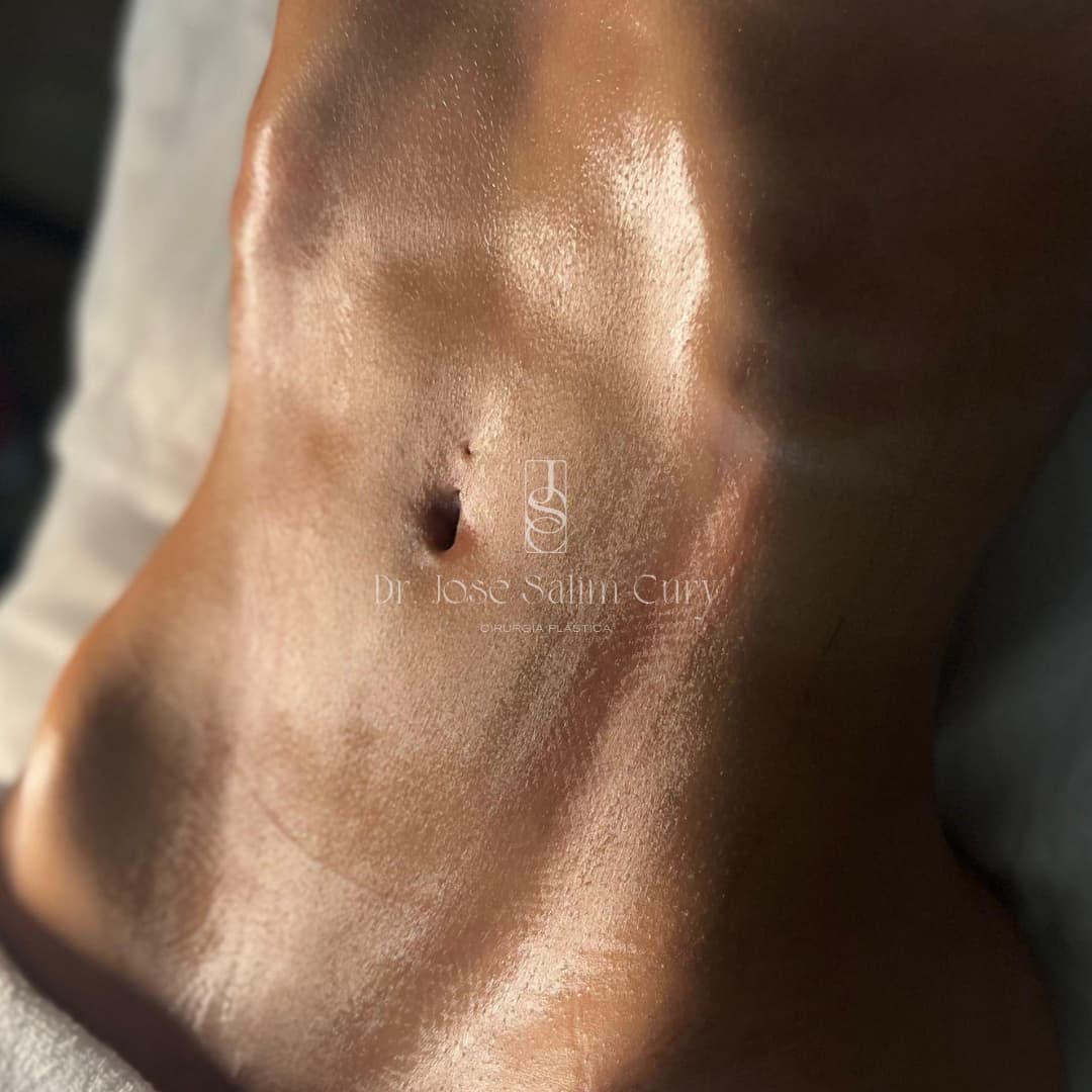 Lipo Lad = Silhueta Equilibrada - Balanced Silhouette