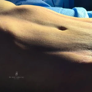 efeito sanfona