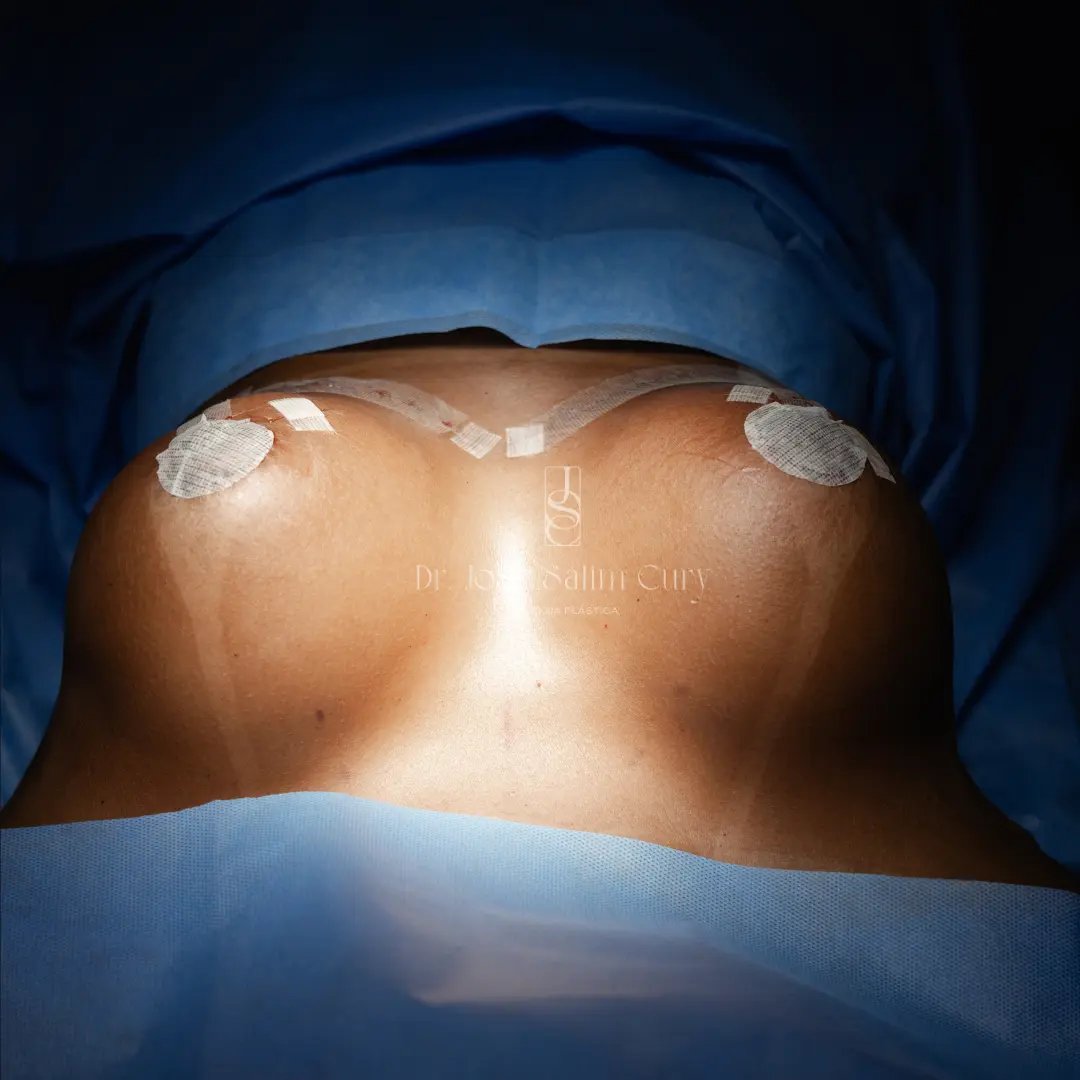 Imagem corporal - Body Image - imagen corporal