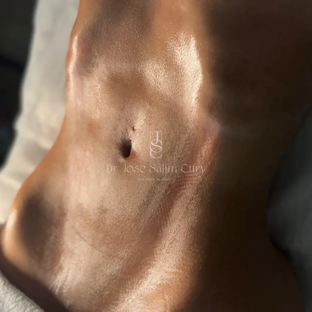 Lipo Lad - Silueta equilibrada