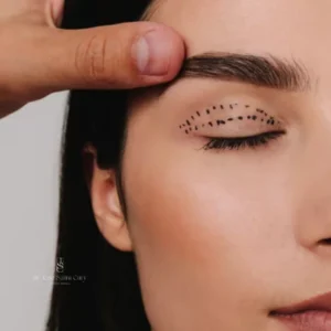 Blepharoplasty