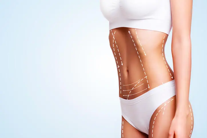 como e lipoaspiracao