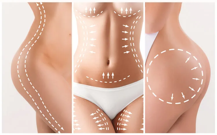 valor lipoabdominoplastia